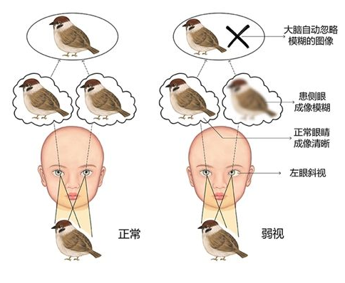 验光师培训学校，正真视光学院